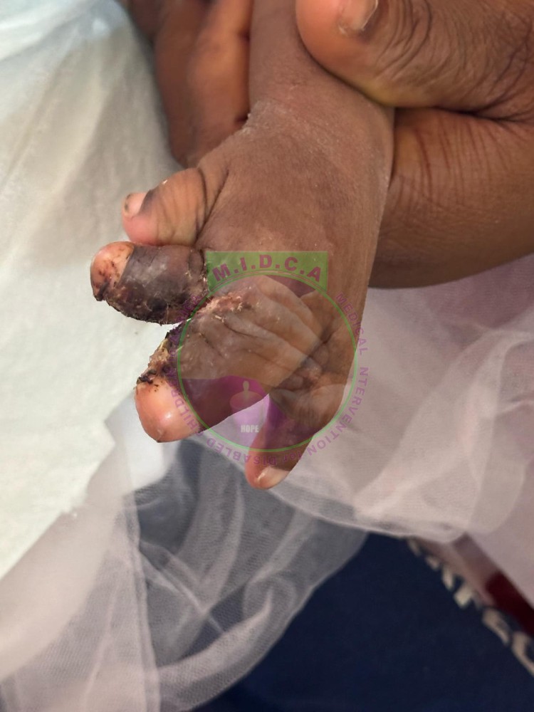 Eveline Fused Fingers Release