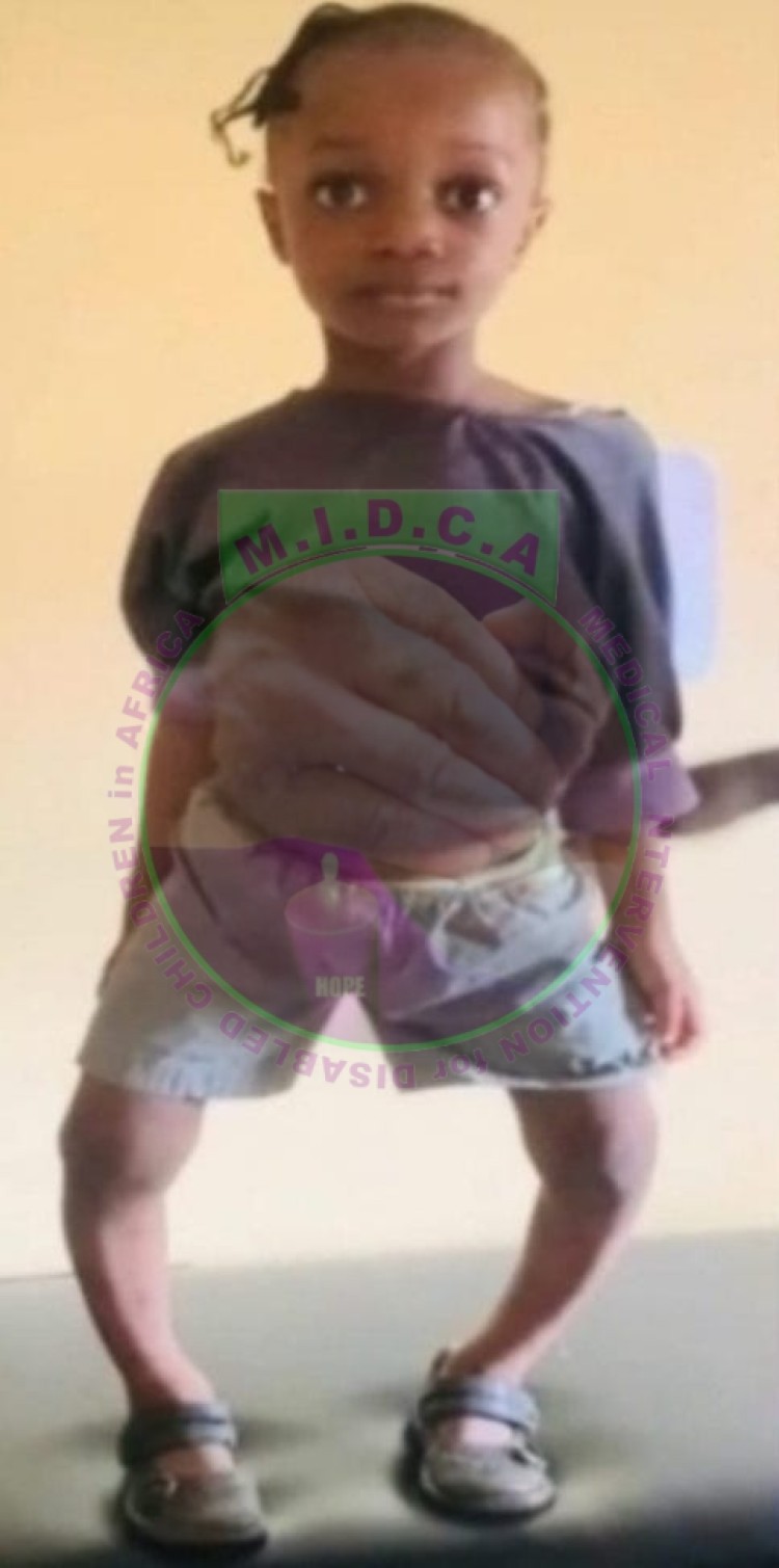 Mercy Bowed Leg Correction