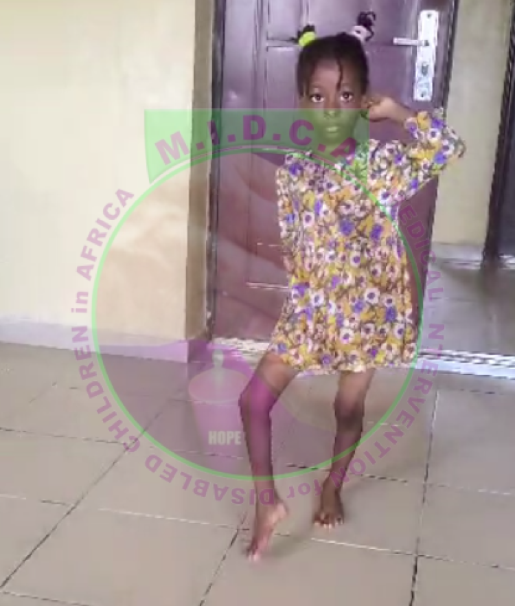 Esther Foot Deformity