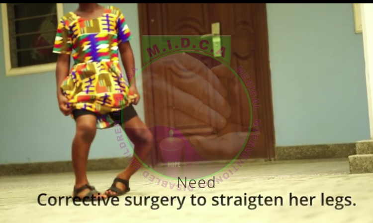 Emmanuella Bilateral Bowed Leg