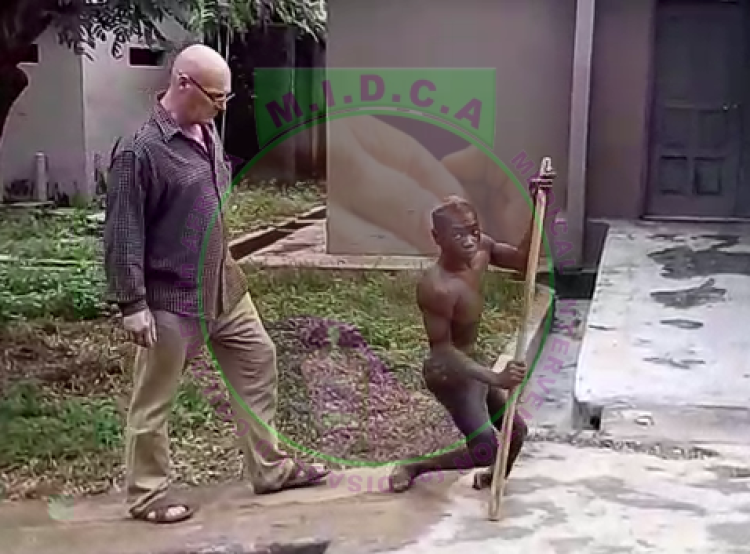 Julius Cerebal Palsy