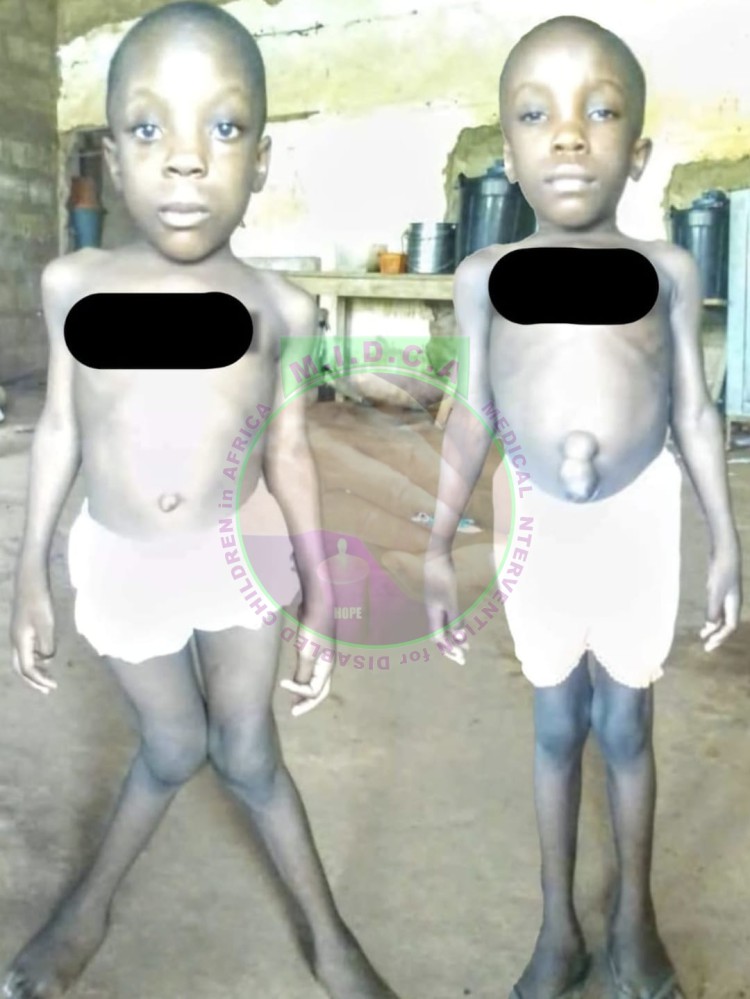 Twins Karen and Kezie K Legs