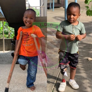 David Prosthetic leg