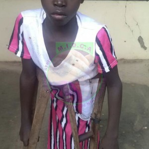 Baraka  Congenital Disorder