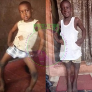 Godwin before & after