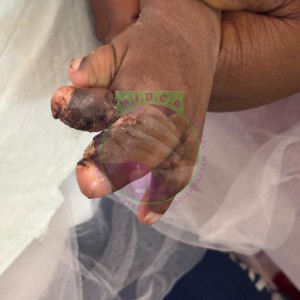 Eveline Fused Fingers Release