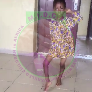 Esther Foot Deformity