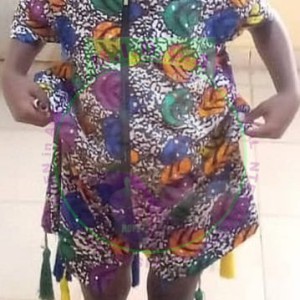 Rodiat Windswept Deformity