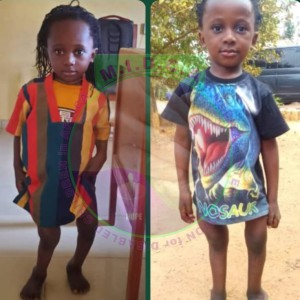 Emmanuel before & after