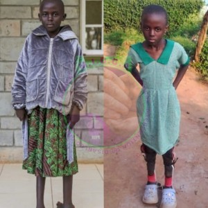 Justina before and after