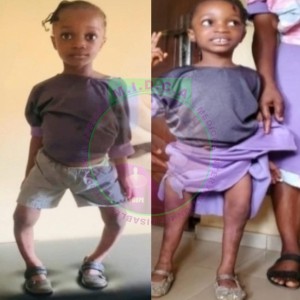 Mercy before & after