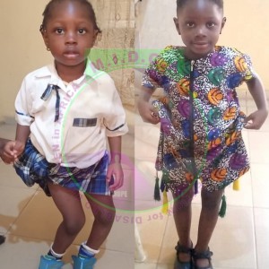 Rodiat before & after