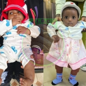 Little Abigael before and after