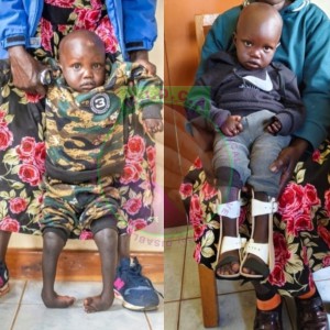 Adrian before and after