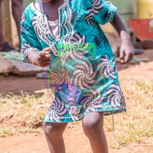 Charles Windswept Deformity